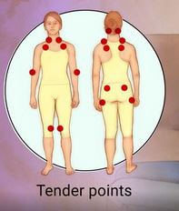 pain body tender points